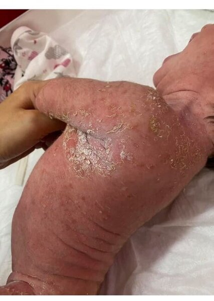 "40-ı çıxsın çimdirərik" deyib körpəni bu hala saldılar - FOTOLAR
