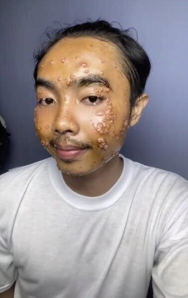 İkinci əl paltar aldı, dərisi bu günə düşdü - FOTO