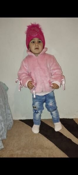 İki yaşlı Dənizin dəstəyə ehtiyacı var: "Müalicələrini davam etdirməyə imkanımız yoxdur" - FOTO