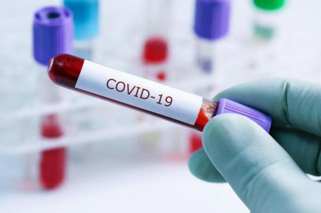 COVID-19-dan ölənlərin sayı 7 milyonu keçdi