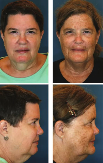 Əkizlərin fotoları YAYILDI: Onlardan biri niyə daha GƏNC GÖRÜNÜR? - FOTO