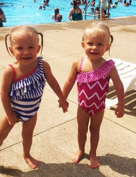 Doğulanda əl-ələ tutan əkizlər indi də ayrılmırlar - FOTOLAR