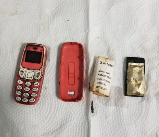 Həkimlər ŞOKDA: Mədəsindən TELEFON ÇIXDI - FOTO