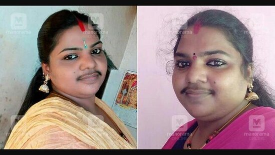 35 yaşlı qadın: Bığsız yaşaya bilmirəm