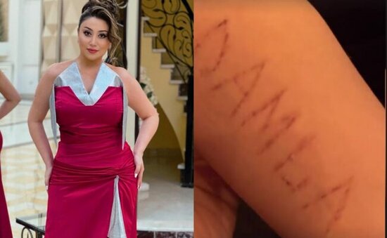 Damla qolunu kəsən fanatı ilə görüşdü