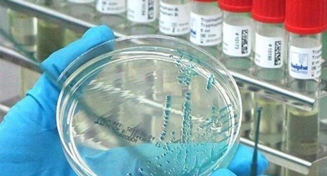 "Beyin yeyən" infeksiya aşkarlandı