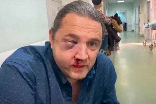 Sabiq deputata hücum anının görüntüləri yayılıb - VİDEO