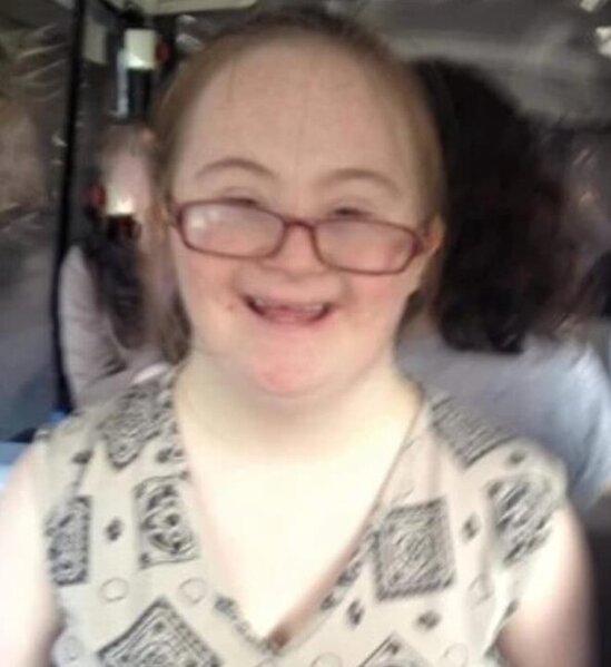 Ana daun sindromlu qızını öldürdü - FOTO