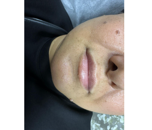 Haqqında şikayət edilən kosmetoloq Gülnar Əhmədova danışdı - AÇIQLAMA