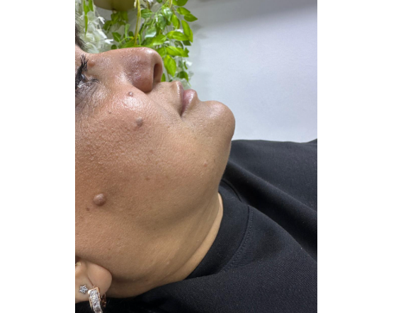 Haqqında şikayət edilən kosmetoloq Gülnar Əhmədova danışdı - AÇIQLAMA