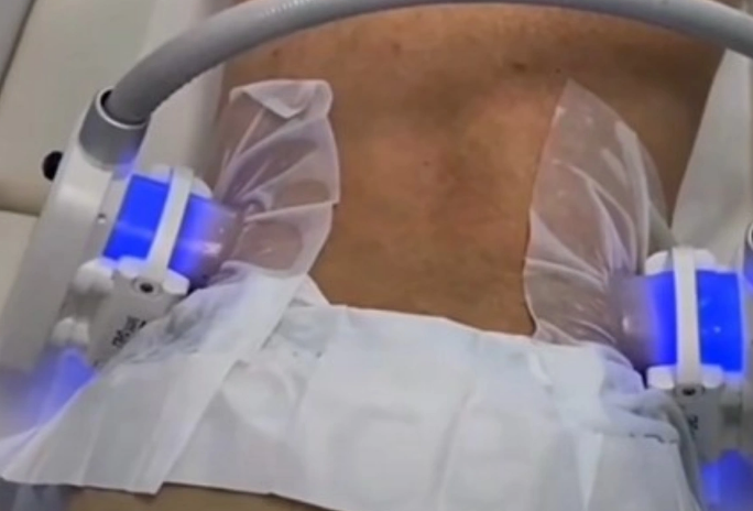 Məşhurlaşan arıqlama üsulunun dəhşətli təhlükəsi