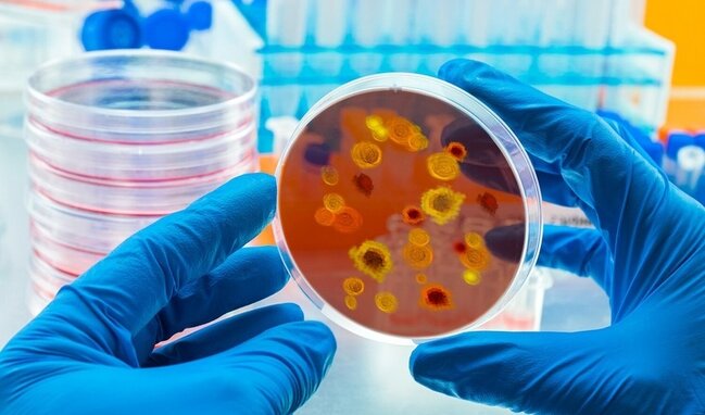 Qonşu ölkədə təhlükəli virusla bağlı XƏBƏRDARLIQ - Nazirlik əhaliyə ÇAĞIRIŞ ETDİ