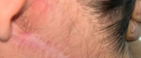 Esmira İbrahimlinin qanunsuz estetik əməliyyatının qurbanı-Şikayətçidir-Foto-Video