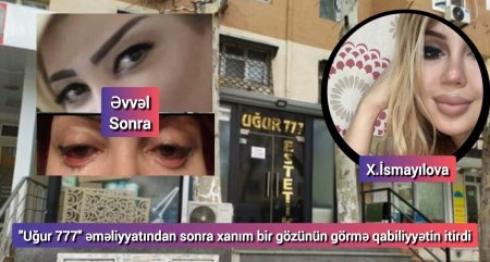 "Uğur 777" Klinikasında: Saxta diplomlar, qüsurlu əməliyyatlar…
