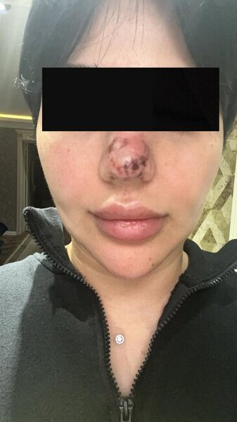 Rəna Soltanovanın daha bir qurbanı danışdı: "İşimdən oldum, külli miqdarda pul itirdim"