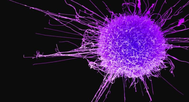 Öskürək bu ölümcül xəstəliyin xəbərçisidir