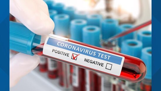 SON DƏQİQƏ: Yoluxanların sayı 2000-ə yaxınlaşır