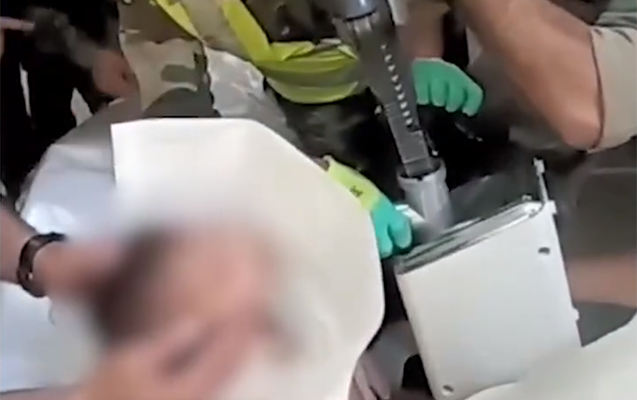 Yaşyarımlıq uşağın əli ətçəkən maşınında qaldı - Video