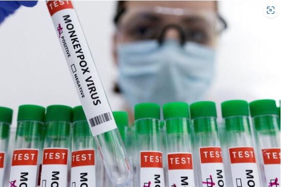 ÜST: "Meymunçiçəyi virusunun adının dəyişdirilməsi üzərində çalışırıq"