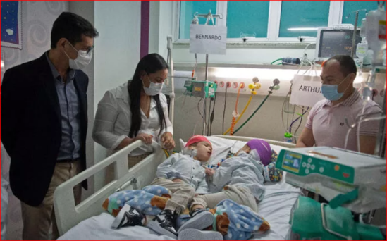 Siyam əkizlərini virtual reallıq ayırdı