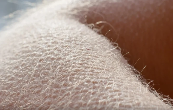 Arzuolunmaz tüklərdən qurtulmağın YOLLARI