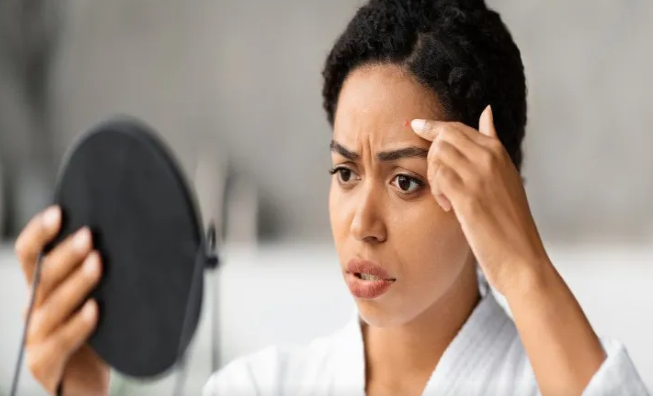 Həyatınızı məhv edən az bilinən dəri xəstəliyi