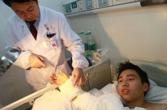 Qopmuş əlini ayağına tikib xilas etdilər - Unikal əməliyyat