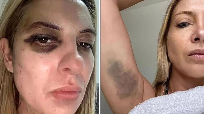 Keçmiş prezident arvadını görün NƏ HALA SALDI - FOTOLAR