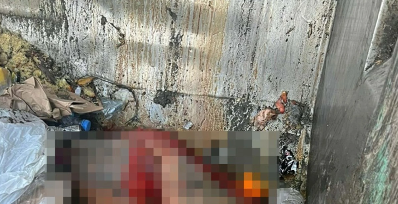 Dəhşət! Küçənin ortasında insan dərisi tapılıb - Gerçəklər ortaya çıxdı, sən demə...