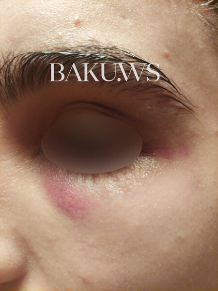 Bakı məktəbində sinif yoldaşları məktəbli qızı vəhşicəsinə döydülər - FOTO/VİDEO