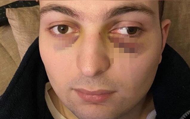Ticarət mərkəzində döyülən oğlanla bağlı araşdırma başladı - Foto