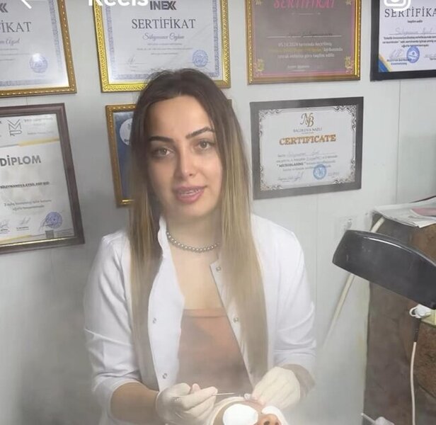 Gəncədə "ixtisaslaşmış kosmetoloq" Aysel Süleymanova tibbi sertifikatı və lisensiyası olmadan necə fəaliyyət göstərir?