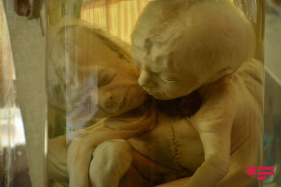 Alim: "Tək yaralı yerimiz meyit azlığıdır" - FOTO