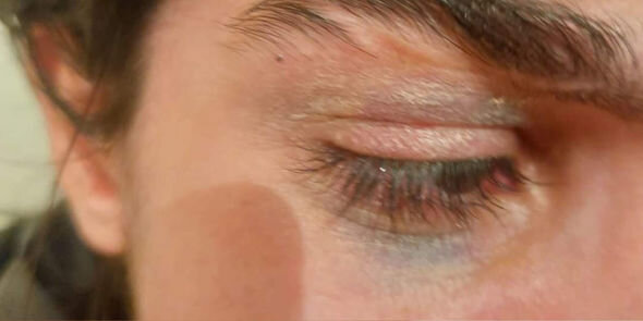 Bakıda ailəsi tərəfindən döyülən məktəbli qız sığınacağa yerləşdirildi - YENİLƏNİB + FOTO