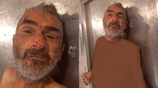 Bakıda qəzada ölən şəxsin yaxınları axtarılır - YENİLƏNİB + FOTO