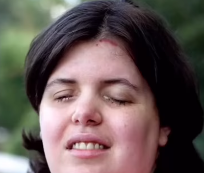 Uşaqlığından bəri "kor olmaq" istəyən qadın - FOTO