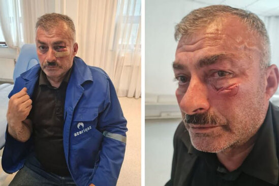 "Azəriqaz"ın əməkdaşına qarşı zor tətbiqi ilə bağlı cinayət işi başlanıb