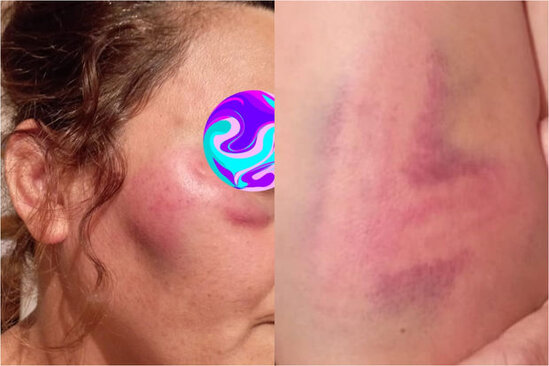 Qaradağda kişinin döyüb evdən qovduğu arvadı əmisi qızı imiş - YENİLƏNİB + FOTO