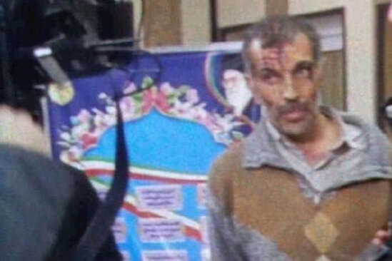 Səfirliyimizə hücum edən şəxsin görüntüsü yayıldı - FOTO