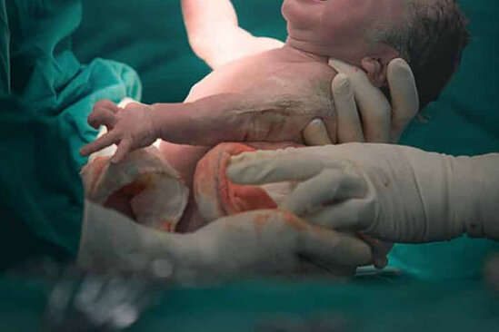 TƏBİB-dən qadının qeysəriyyə əməliyyatından sonra ölümünün səbəbi ilə bağlı AÇIQLAMA