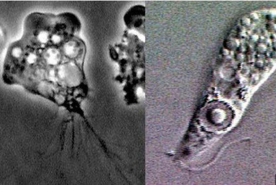 ABŞ-də "beyin yeyən amöb" can aldı - FOTO