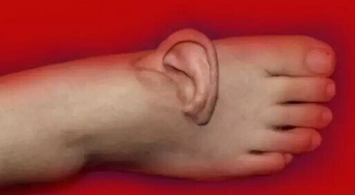 Beş ay müddətində qulağını ayağında daşıdı - FOTO