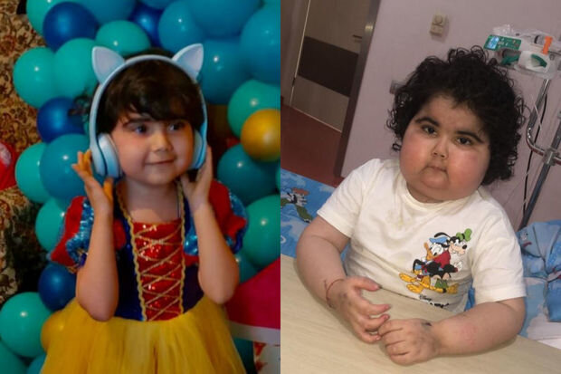 Ayan iki yaşından xərçənglə mübarizə aparır: Qolları göyərib, bədəni şişib - FOTO