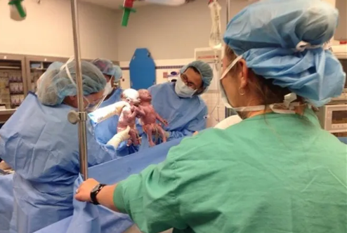 Doğulanda əl-ələ tutan əkizlər indi də ayrılmırlar - FOTOLAR