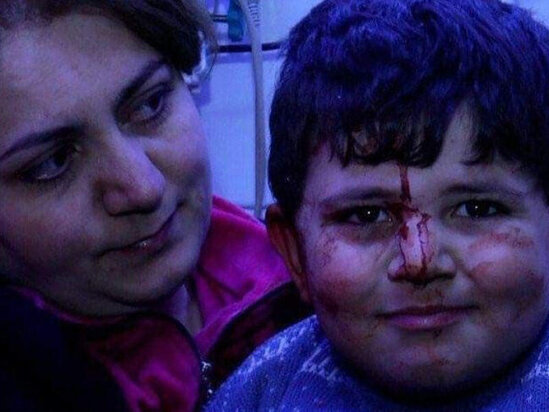 Erməni terrorunun canlı şahidi 6 yaşlı Bəxtiyar: "Evimizə bomba düşəndə qorxmadım, heç kişi də qorxar?" - VİDEO
