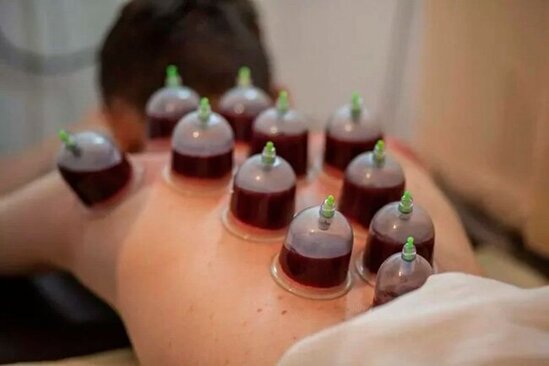 "Bir gün Allah göstərməsin, kimsə hicamadan vəfat edərsə..." - Səhv hicamanın fəsadları AÇIQLANDI