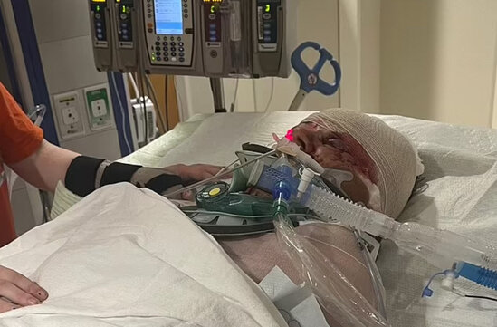 3 uşaq anasına itlər hücum etdi, qolları kəsildi - FOTOLAR