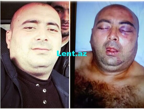 Zaqatalada keçmiş məhkum ölümcül döyüldü - FOTO