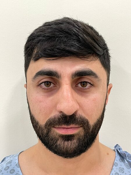 Məşhur plastik cərrahdan NÜMUNƏVİ ADDIM: Qazimizi pulsuz əməliyyat etdi - FOTO