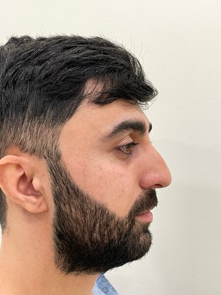 Məşhur plastik cərrahdan NÜMUNƏVİ ADDIM: Qazimizi pulsuz əməliyyat etdi - FOTO